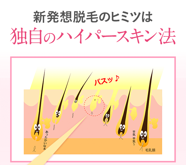 新発想脱毛のひヒミツは独自の「ハイパースキン法」