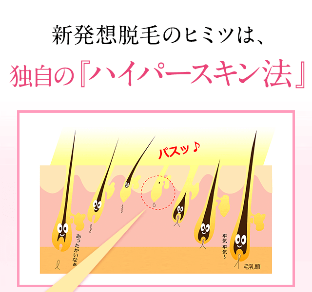 新発想脱毛のひヒミツは独自の「ハイパースキン法」